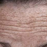 Simple Ways To Reduce Your Unwanted Wrinkles!