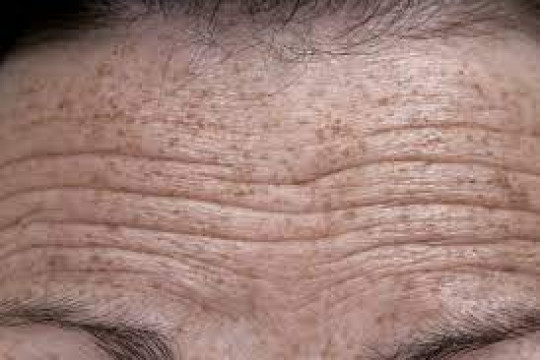 Simple Ways To Reduce Your Unwanted Wrinkles!
